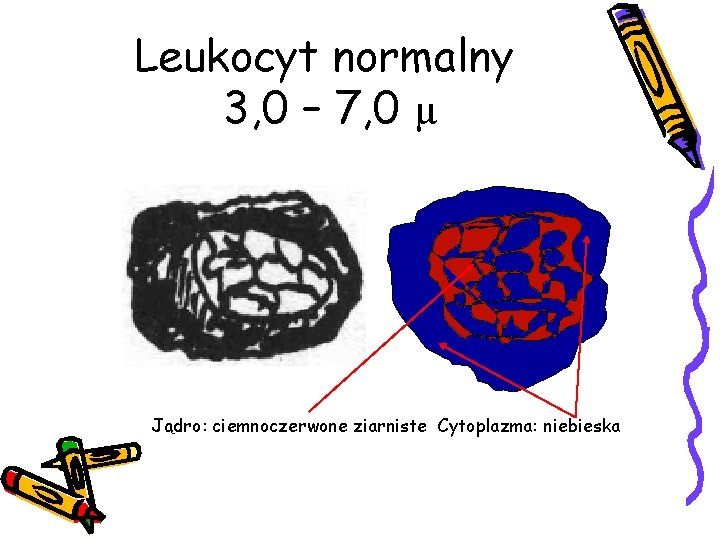 Leukocyt normalny 3, 0 – 7, 0 µ Jądro: ciemnoczerwone ziarniste Cytoplazma: niebieska 