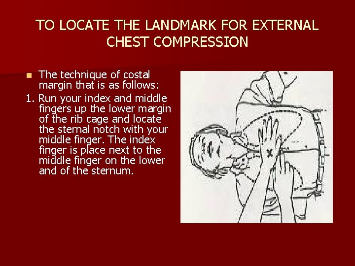 TO LOCATE THE LANDMARK FOR EXTERNAL CHEST COMPRESSION The technique of costal margin that