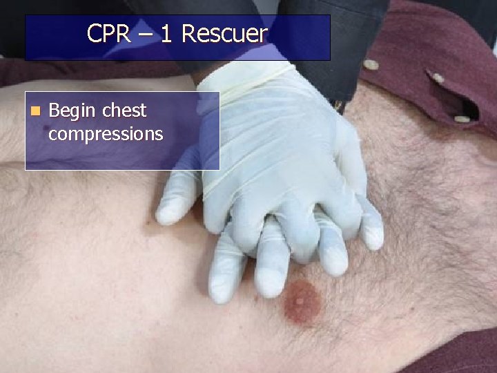 CPR – 1 Rescuer n Begin chest compressions 