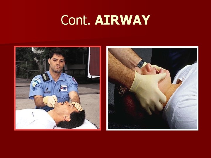 Cont. AIRWAY 