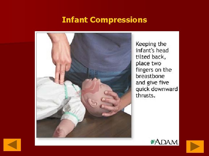 Infant Compressions 