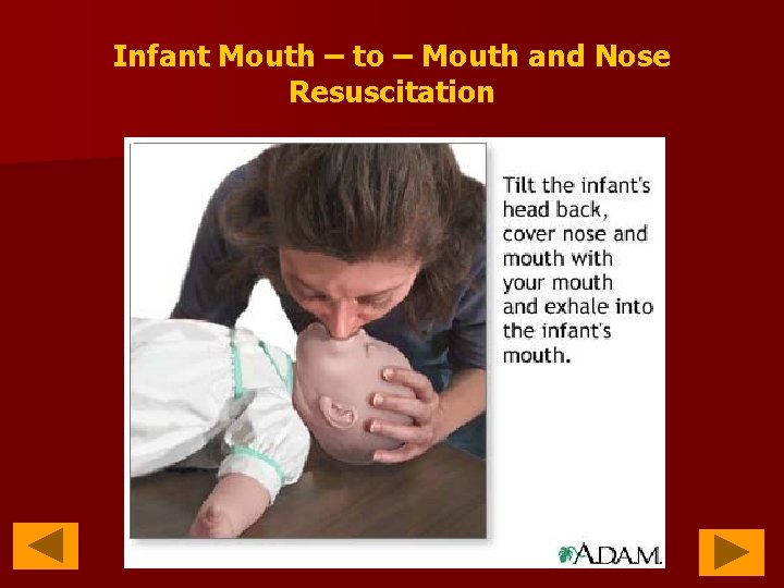 Infant Mouth – to – Mouth and Nose Resuscitation 