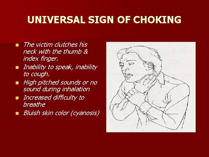 UNIVERSAL SIGN OF CHOKING n n n The victim clutches his neck with the