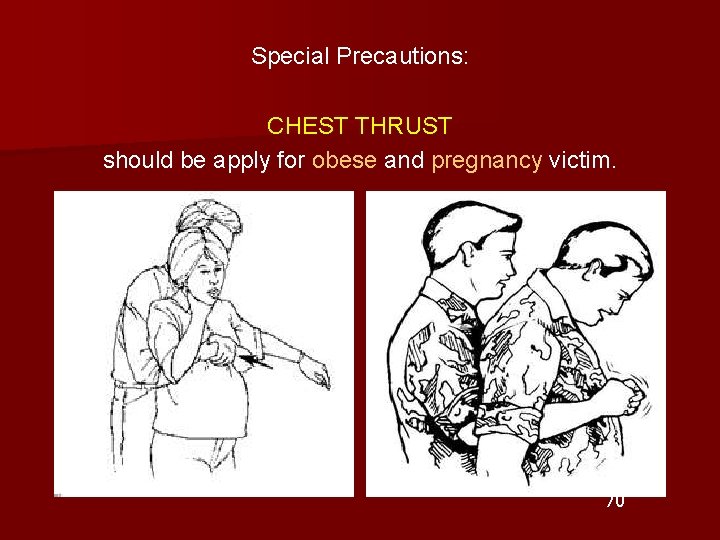 Special Precautions: CHEST THRUST should be apply for obese and pregnancy victim. 70 