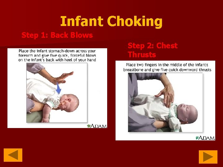 Infant Choking Step 1: Back Blows Step 2: Chest Thrusts 