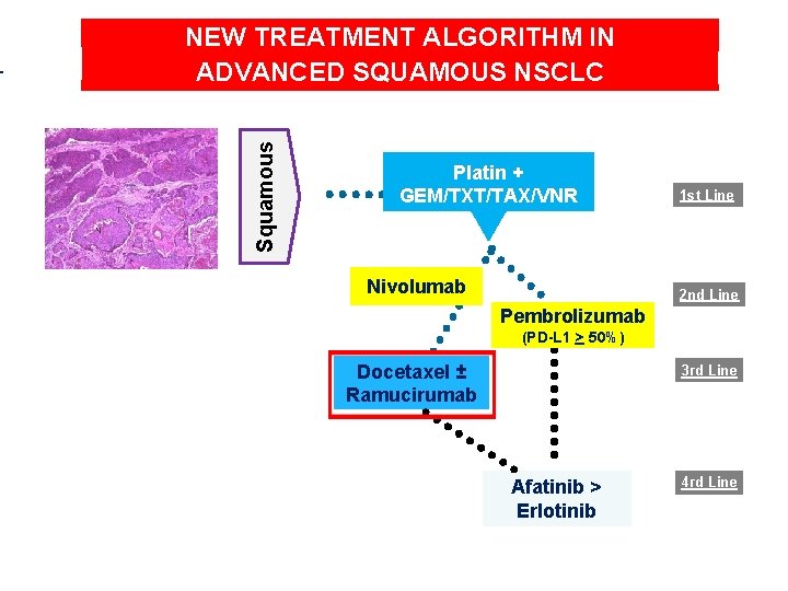 Squamous NEW TREATMENT ALGORITHM IN ADVANCED SQUAMOUS NSCLC Platin + GEM/TXT/TAX/VNR Nivolumab 1 st