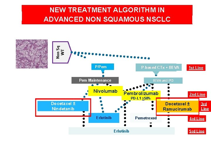 Non Sq WT NEW TREATMENT ALGORITHM IN ADVANCED NON SQUAMOUS NSCLC P/Pem P-based CTx