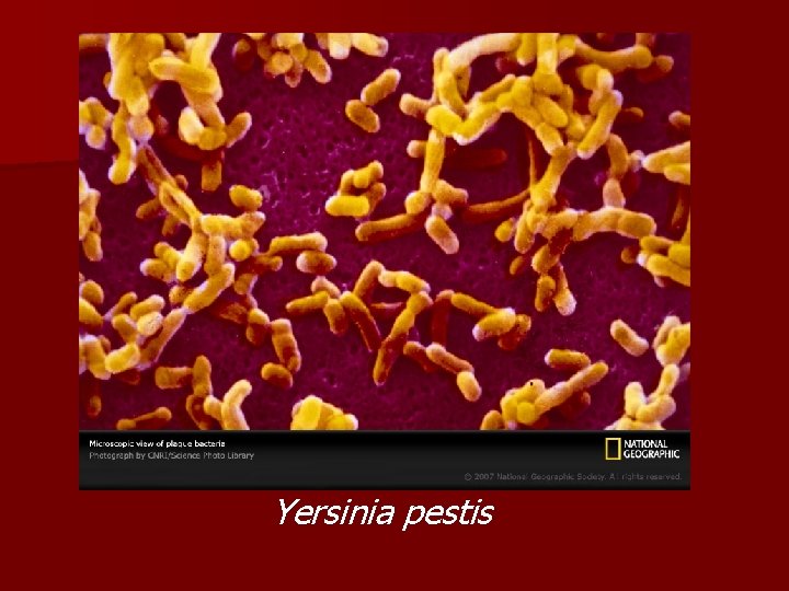 Yersinia pestis Yersinia pestis