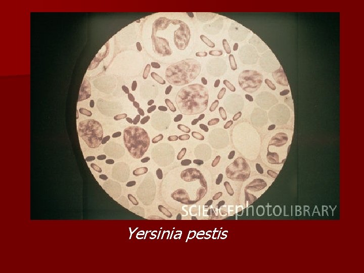 Yersinia pestis Yersinia pestis
