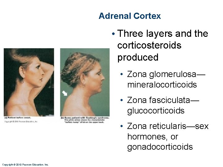 Adrenal Cortex • Three layers and the corticosteroids produced • Zona glomerulosa— mineralocorticoids •