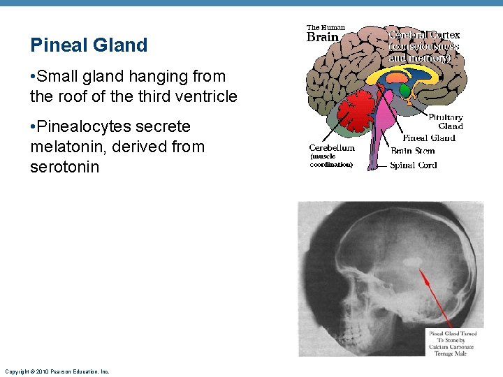 Pineal Gland • Small gland hanging from the roof of the third ventricle •