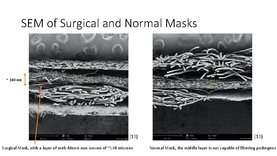 SEM of Surgical and Normal Masks ~ 140 um [13] Surgical Mask, with a