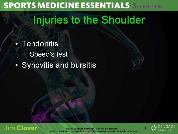 Injuries to the Shoulder • Tendonitis – Speed’s test • Synovitis and bursitis 11