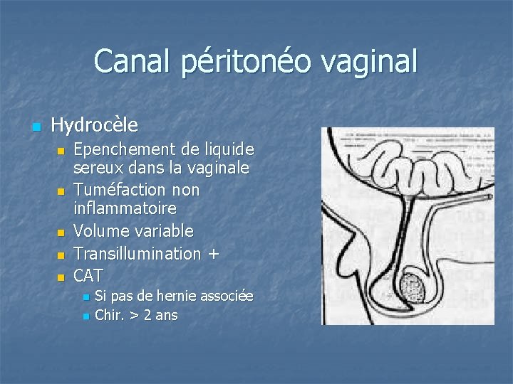 Canal péritonéo vaginal n Hydrocèle n n n Epenchement de liquide sereux dans la