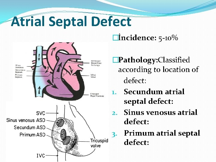 Atrial Septal Defect �İncidence: 5 -10% �Pathology: Classified according to location of defect: 1.