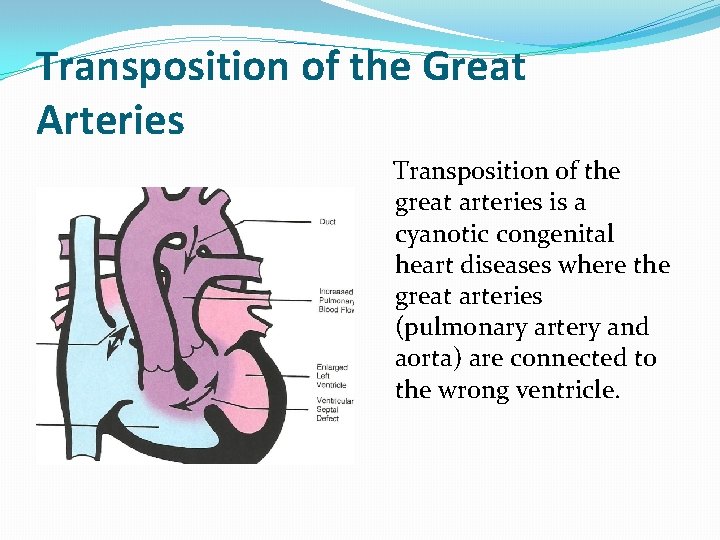 Transposition of the Great Arteries Transposition of the great arteries is a cyanotic congenital