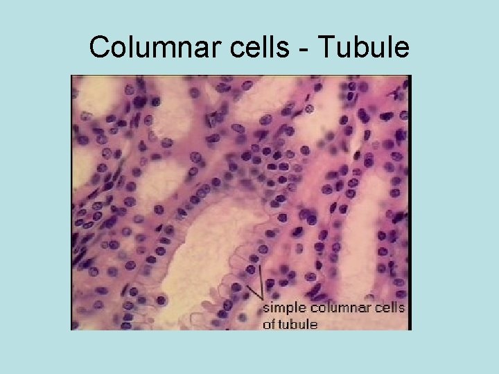 Columnar cells - Tubule 