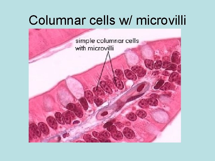 Columnar cells w/ microvilli 