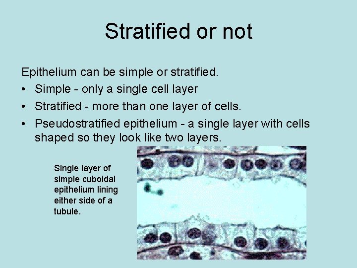 Stratified or not Epithelium can be simple or stratified. • Simple - only a