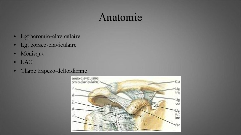 Anatomie • • • Lgt acromio-claviculaire Lgt coraco-claviculaire Ménisque LAC Chape trapezo-deltoidienne 