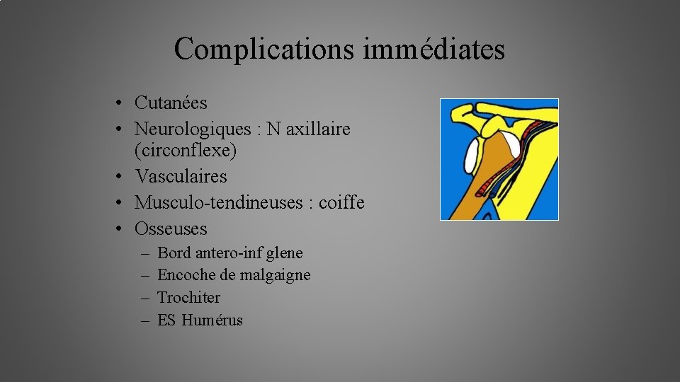 Complications immédiates • Cutanées • Neurologiques : N axillaire (circonflexe) • Vasculaires • Musculo-tendineuses