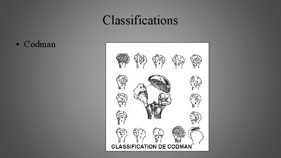 Classifications • Codman 