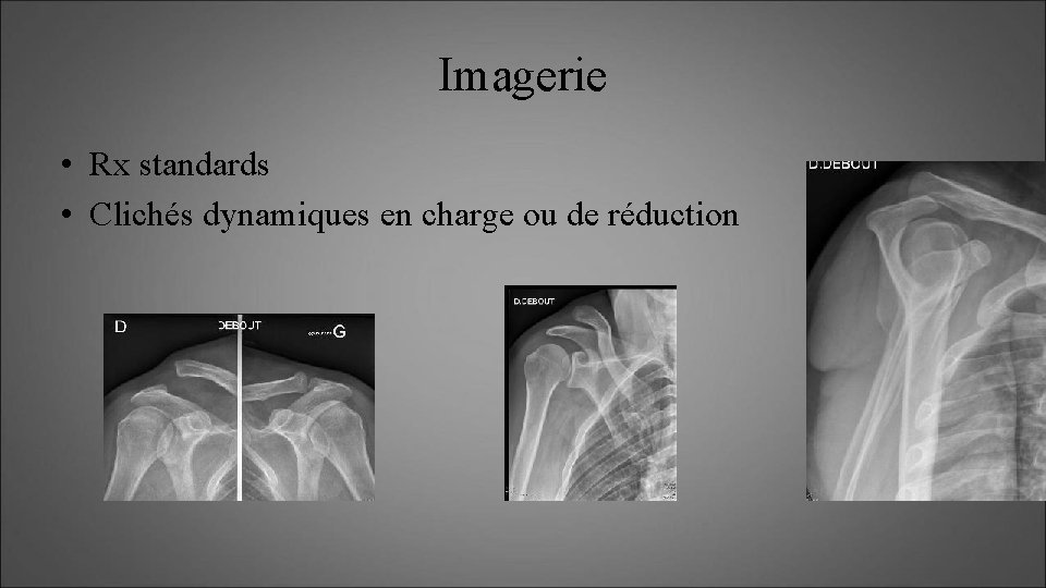 Imagerie • Rx standards • Clichés dynamiques en charge ou de réduction 