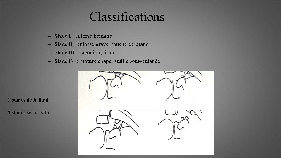 Classifications – – 3 stades de Julliard 4 stades selon Patte Stade I :