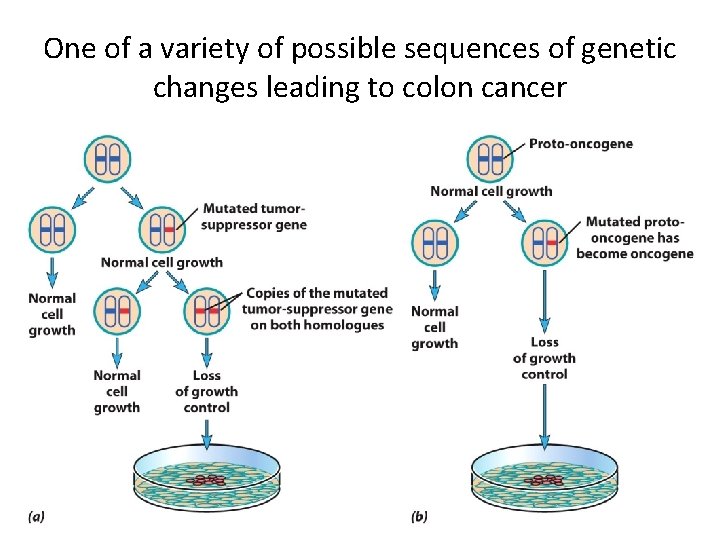 One of a variety of possible sequences of genetic changes leading to colon cancer