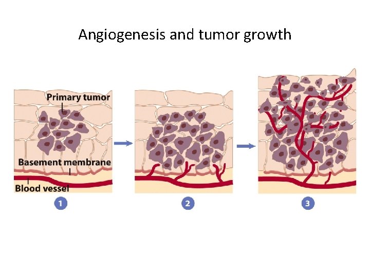 Angiogenesis and tumor growth 