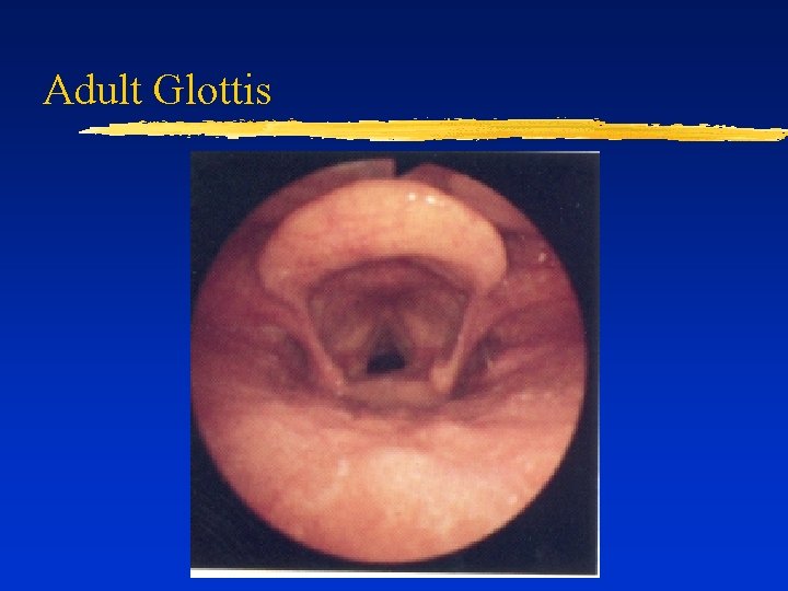 Adult Glottis 