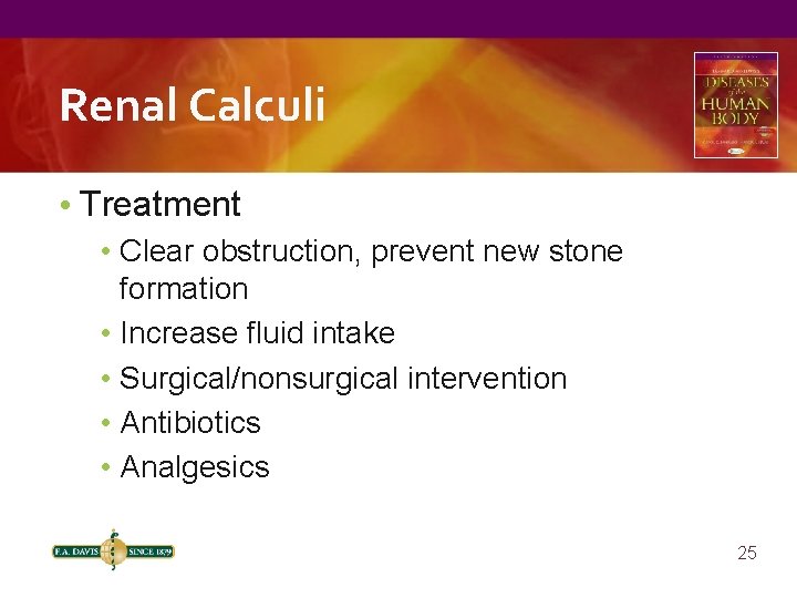 Renal Calculi • Treatment • Clear obstruction, prevent new stone formation • Increase fluid