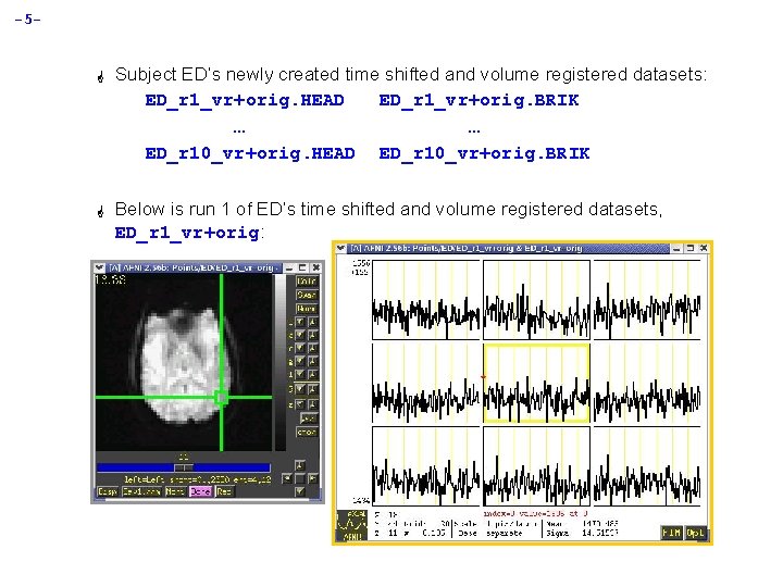 -5 - G Subject ED’s newly created time shifted and volume registered datasets: ED_r