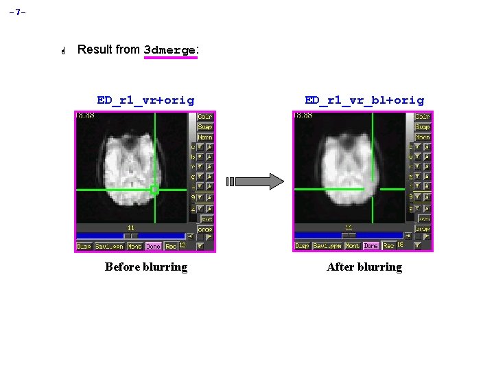 -7 - G Result from 3 dmerge: ED_r 1_vr+orig ED_r 1_vr_bl+orig Before blurring After