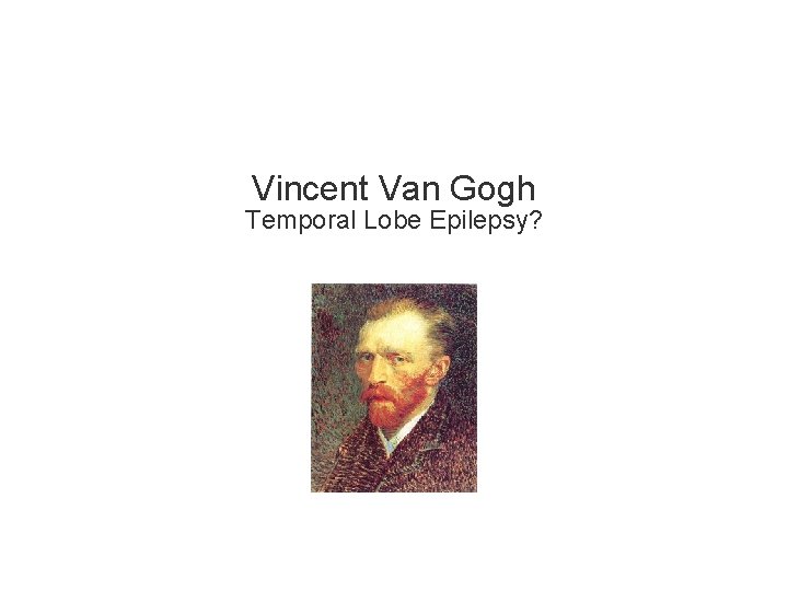 Vincent Van Gogh Temporal Lobe Epilepsy? 1 