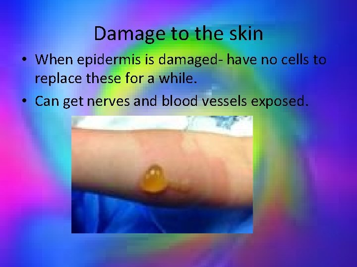 Damage to the skin • When epidermis is damaged- have no cells to replace