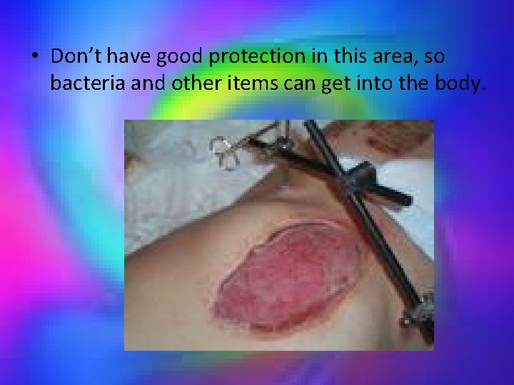  • Don’t have good protection in this area, so bacteria and other items