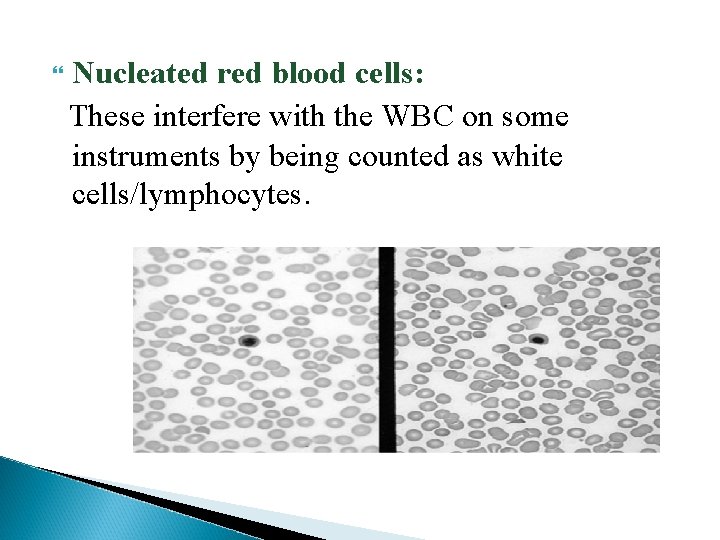  Nucleated red blood cells: These interfere with the WBC on some instruments by