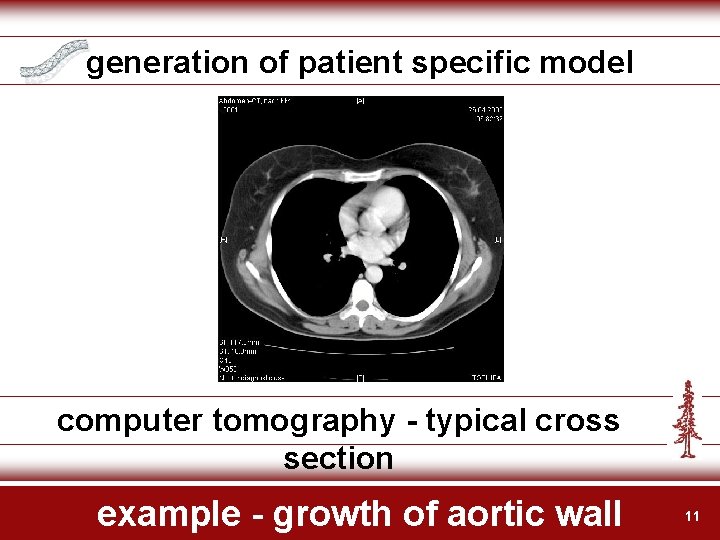 generation of patient specific model computer tomography - typical cross section example - growth
