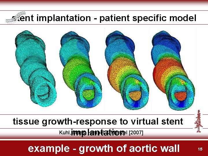 stent implantation - patient specific model tissue growth-response to virtual stent Kuhl, implantation Maas,