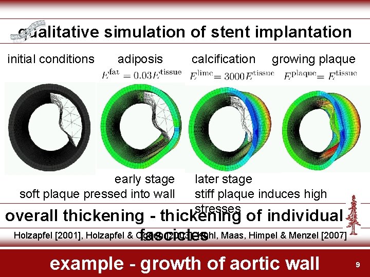 qualitative simulation of stent implantation initial conditions adiposis early stage soft plaque pressed into