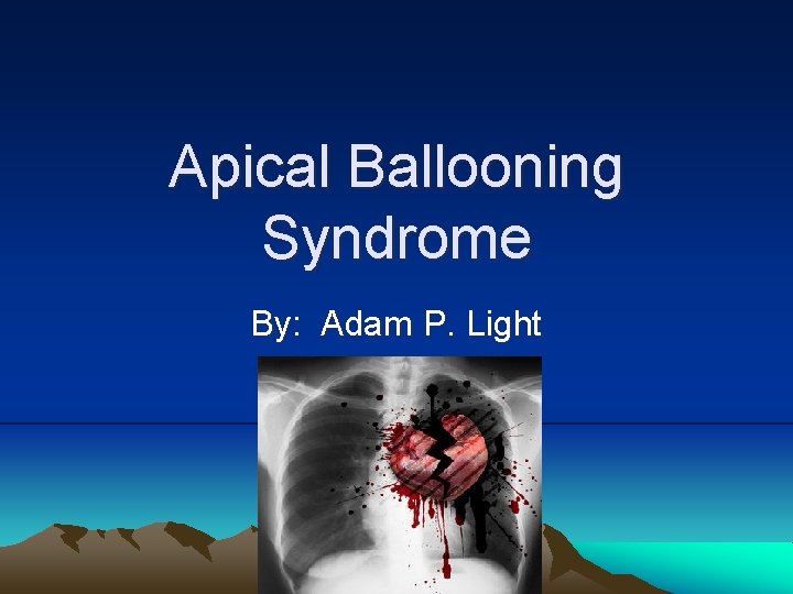 Apical Ballooning Syndrome By: Adam P. Light 