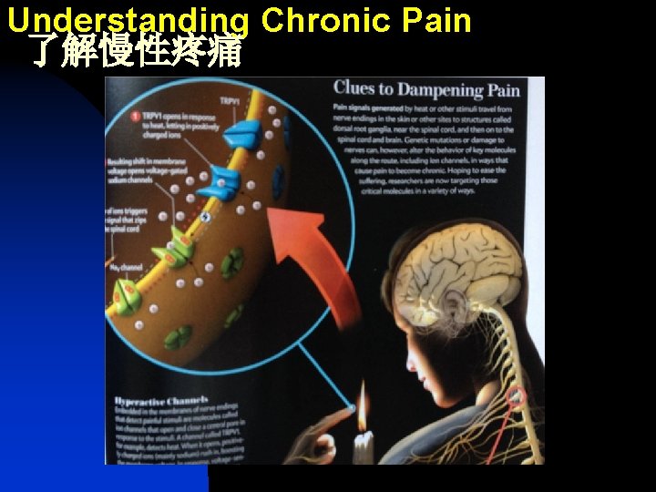 Understanding Chronic Pain 了解慢性疼痛 