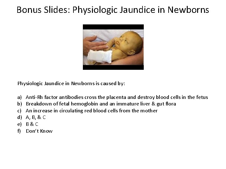 Bonus Slides: Physiologic Jaundice in Newborns is caused by: a) b) c) d) e)