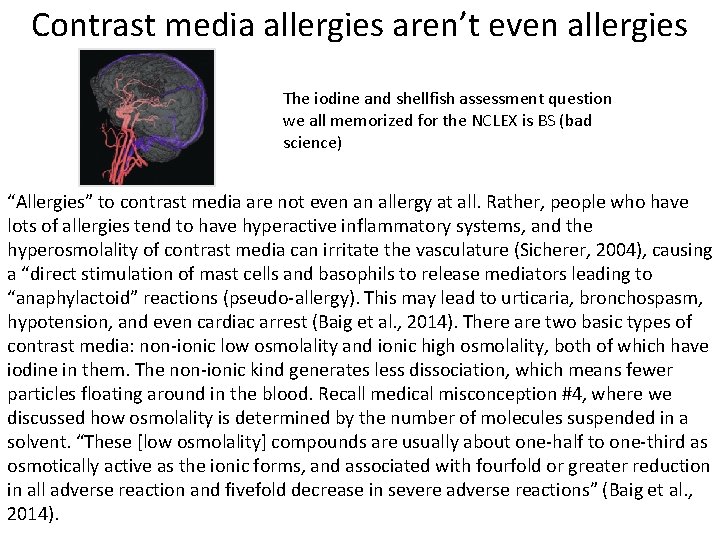 Contrast media allergies aren’t even allergies The iodine and shellfish assessment question we all