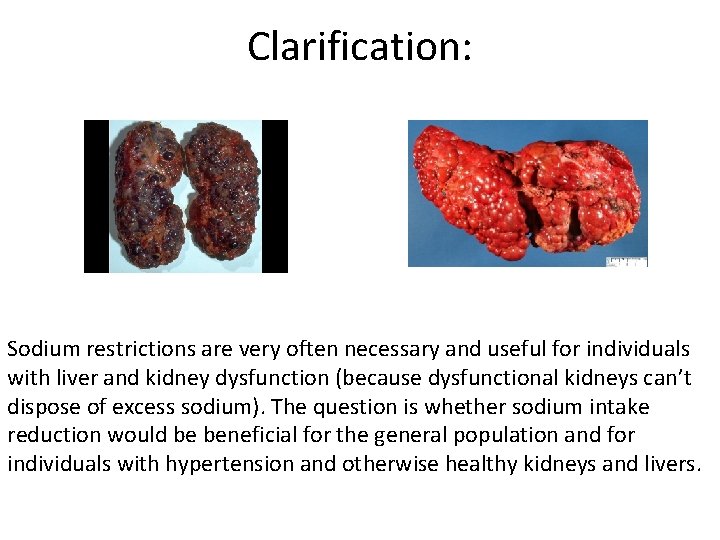 Clarification: Sodium restrictions are very often necessary and useful for individuals with liver and