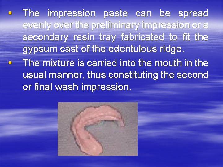 § The impression paste can be spread evenly over the preliminary impression or a