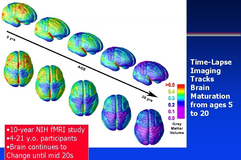 Time-Lapse Imaging Tracks Brain Maturation from ages 5 to 20 • 10 -year NIH Time-Lapse Imaging Tracks Brain Maturation from ages 5 to 20 • 10 -year NIH