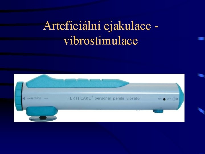 Arteficiální ejakulace vibrostimulace 