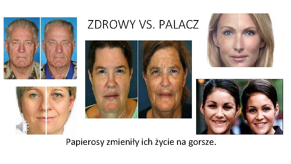 ZDROWY VS. PALACZ Papierosy zmieniły ich życie na gorsze. 